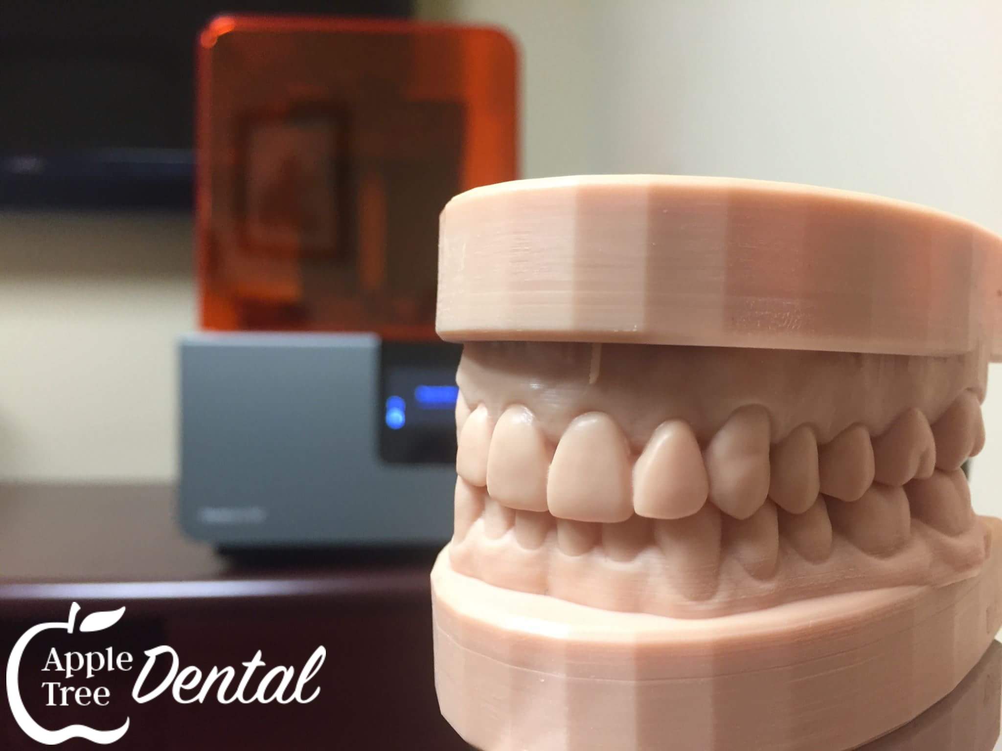 No Messy Dental Impressions! Blog